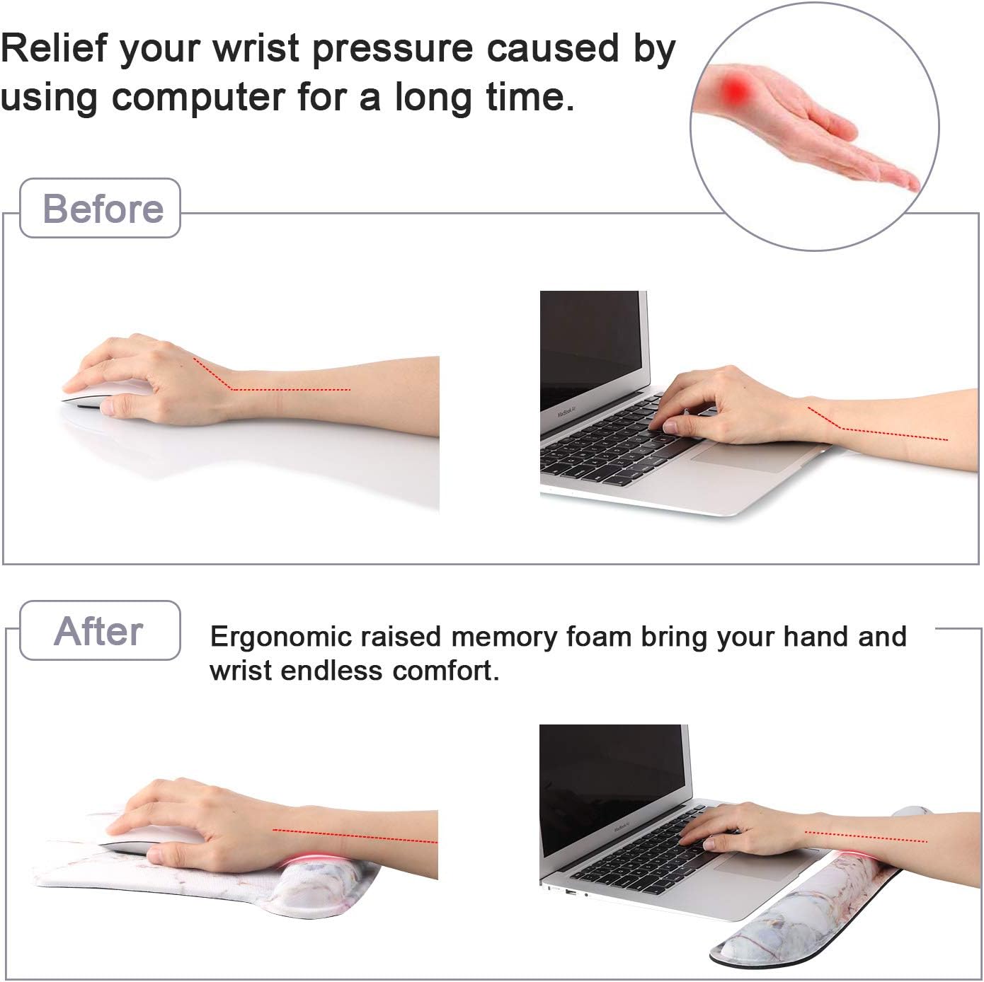 iLeadon Keyboard Wrist Rest Pad and Mouse Wrist Rest Support Mouse Pad Set, Non Slip Rubber Base Wrist Support with Ergonomic Raised Memory Foam for Easy Typing & Pain Relief, Colorful Marble : Office Products