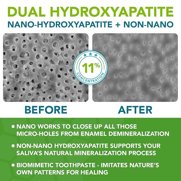 NANO HYDROXYAPATITE TOOTHPASTE FLUORIDE-FREE, PRO MINERALIZER TOOTHPASTE: DENTIST FORMULATED REMINERALIZING ANTI CAVITY XYLITOL TOOTHPASTE, ENAMEL SUPPORT SENSITIVE TEETH TOOTHPASTE – PEPPERMINT WOW