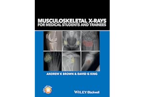 Musculoskeletal X-Rays for Medical Students and Trainees
