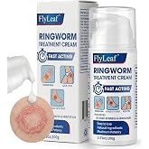 Antifungal Ringworm Treatment Cream, - Miconazole Nitrate 2% Antifungal Cream for Humans - For Fast Itch Relief, Jock Itch &amp; Athlete's Foot - Cream with Ceramides &amp; Tea Tree Oil, Non-Greasy, 3.53oz