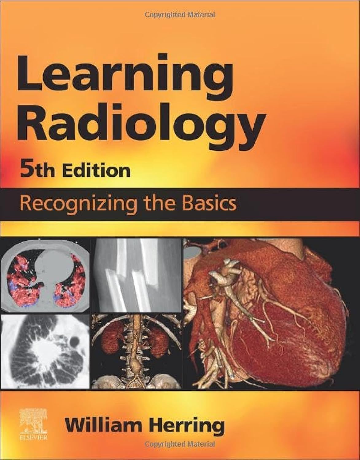 Learning Radiology W/Access
