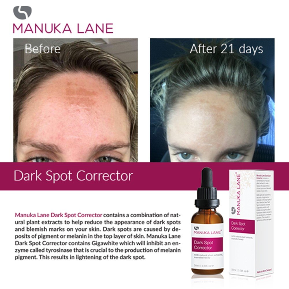 revolution dark spot corrector