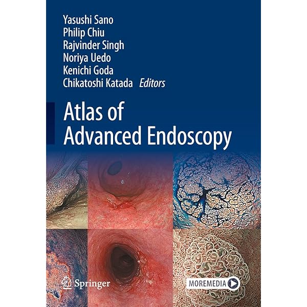 Gastrointestinal Disease: vOL. 1: 医書大型洋書 51V2CPGSQML._UF350,350_QL50_.jpg