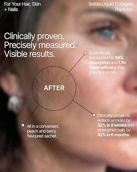 BEME BERADIANT LIQUID COLLAGEN PEPTIDE FOR HAIR, SKIN & NAILS WITH 2X FASTER ABSORPTION – CLINICALLY TESTED – 2500MG VERISOL® HYDROLYZED COLLAGEN SUPPLEMENTS FOR WOMEN WITH BIOTIN, COQ10 & VITAMIN C