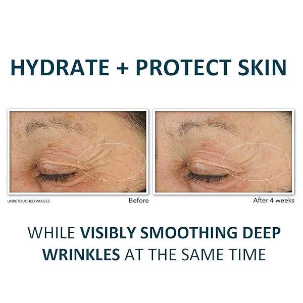 ROC RETINOL CORREXION DEEP WRINKLE DAILY FACE MOISTURIZER WITH SUNSCREEN SPF 30 FOR FINE LINES, DARK SPOTS, POST-ACNE SCARS, 1 OUNCE (PACKAGING MAY VARY)
