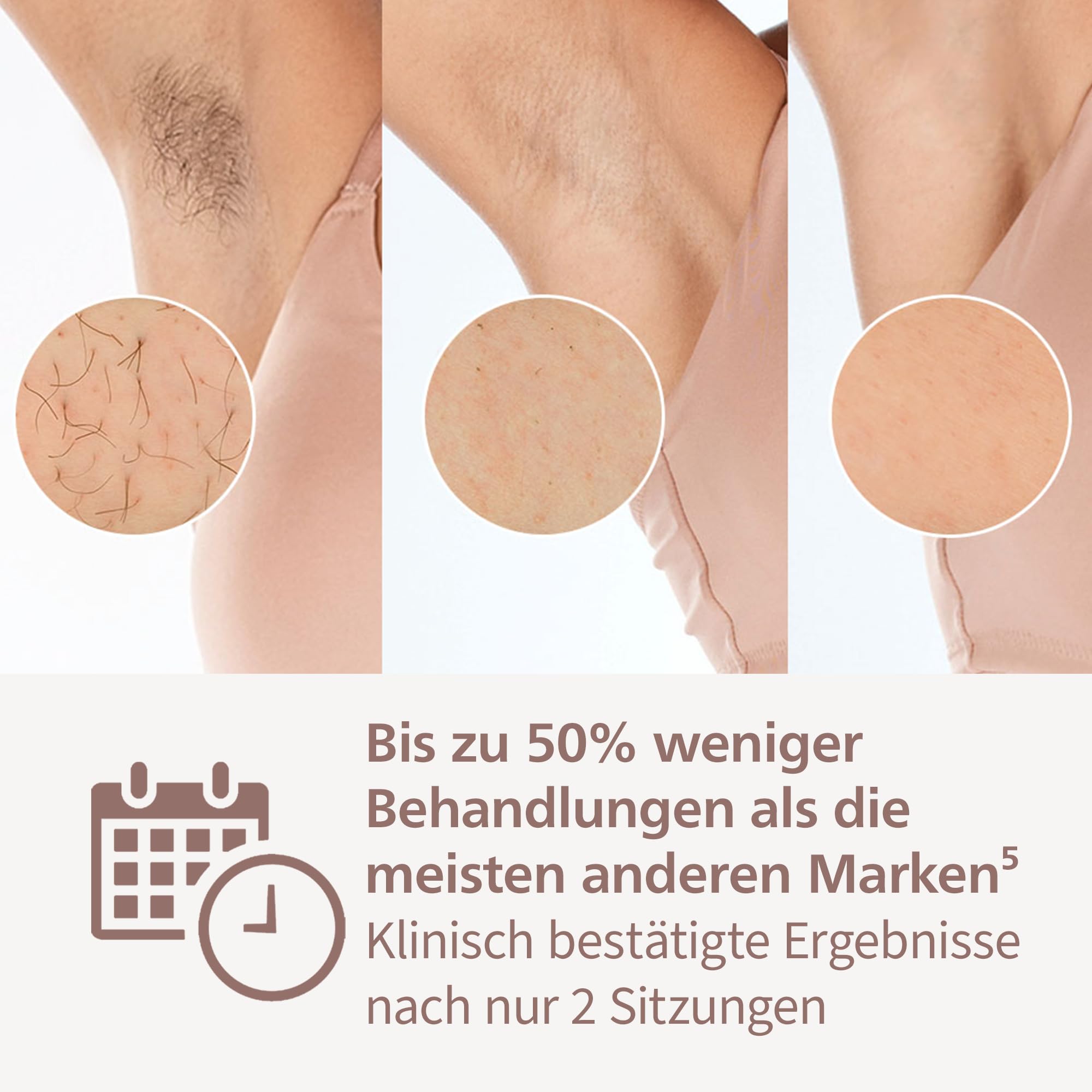 Philips Lumea IPL 8000 Series Haarentfernungsgerät mit SenseIQ Technologie – Alternative zur Laserhaarentfernung – 3 Aufsätze für Körper, Gesicht & Präzisionsbereiche (BRI946/00) 4