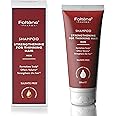 Foltene Shampoo for Thinning Hair for Men - Hair Growth Shampoo Reduces Hair Thinning - Our Hair Loss Shampoo Strengthens Hair & Boosts Volume - Thickening Shampoo Silicone & Sulfate Free -6.76 Fl.oz