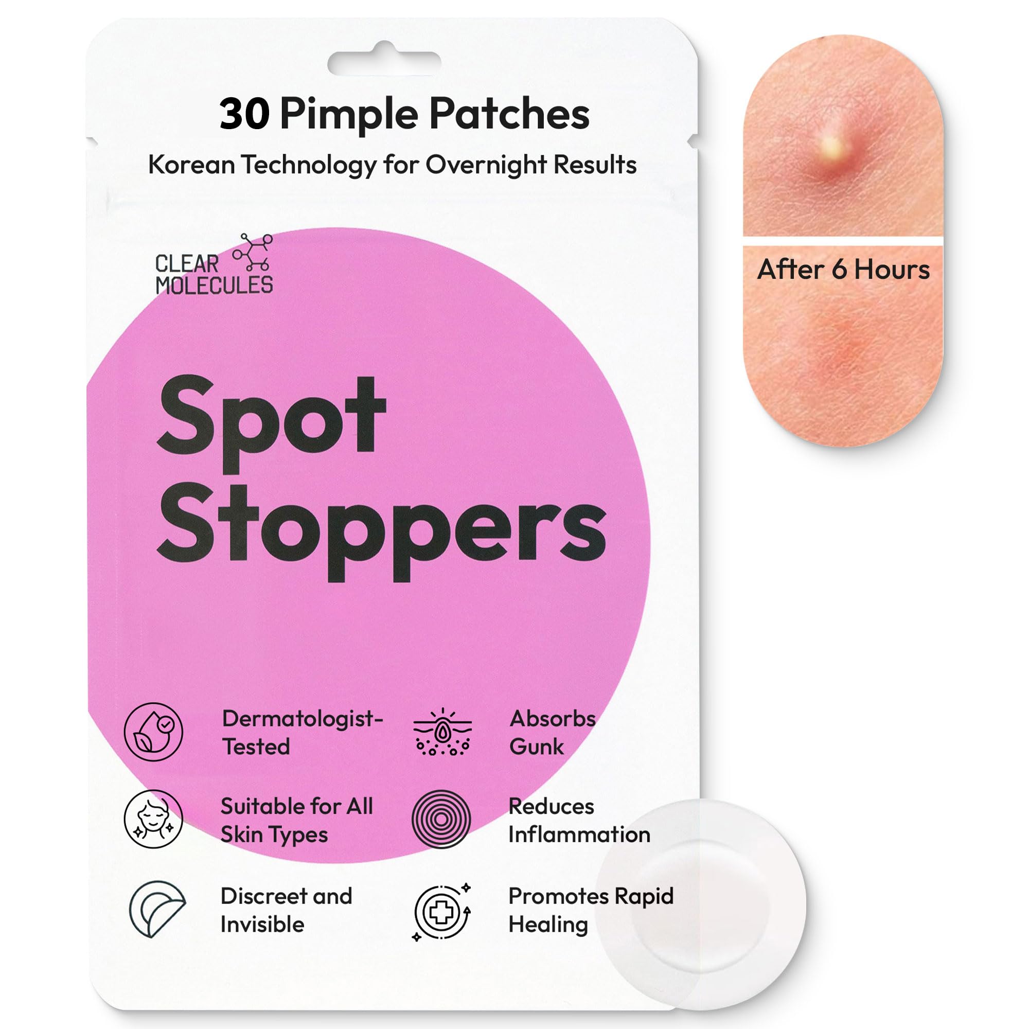 Spot Stoppers Spot Patches - Invisible Pimple Patches for Acne Treatment, Hydrocolloid Patches for Spot Treatment, Vegan & Cruelty Free Korean Skincare Acne Patches (30 Patches)