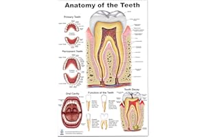 BLUE TREE PUBLISHING Anatomy of the Teeth, Tooth Decay size 24Wx36T