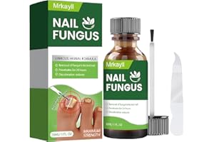 LINDESA 1pcs Toenail Fungus Treatment: Toenail Fungus Treatment Extra Strength - Nail Fungus Treatment for Toenail - Toe Nail Fungus Treatment Extra Strength - Nail Fungus Treatment - Safely and Gently - 30ml