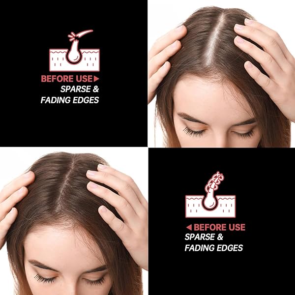 CHOWMI PURE RAW BATANA OIL FOR HAIR GROWTH – UNREFINED DR. SEBI FORMULA FROM HONDURAS – PROMOTES HAIR THICKNESS FOR MEN & WOMEN