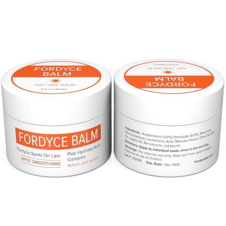 fordyce spots removal cream