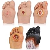Ultrassist Diabetic Foot Care Model Set, Grade 1-5, 5 pcs | Five stages, polymer material, fixed bases, ulcer, infection and necrotic tissue details