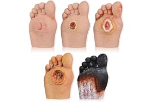 ULTRASSIST 5 Pcs Diabetic Foot Care Model - Grade 1-5 Diabetic Foot Nursing Simulator Model, Human Foot Model for Anatomy, Physiology, Wound Care Demonstrations Tool