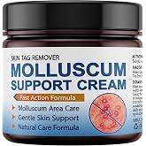 NateNatenight Molluscum Support Treatment, Molluscum Support Cream All Natural Support Cream for Molluscum Rash, 30g