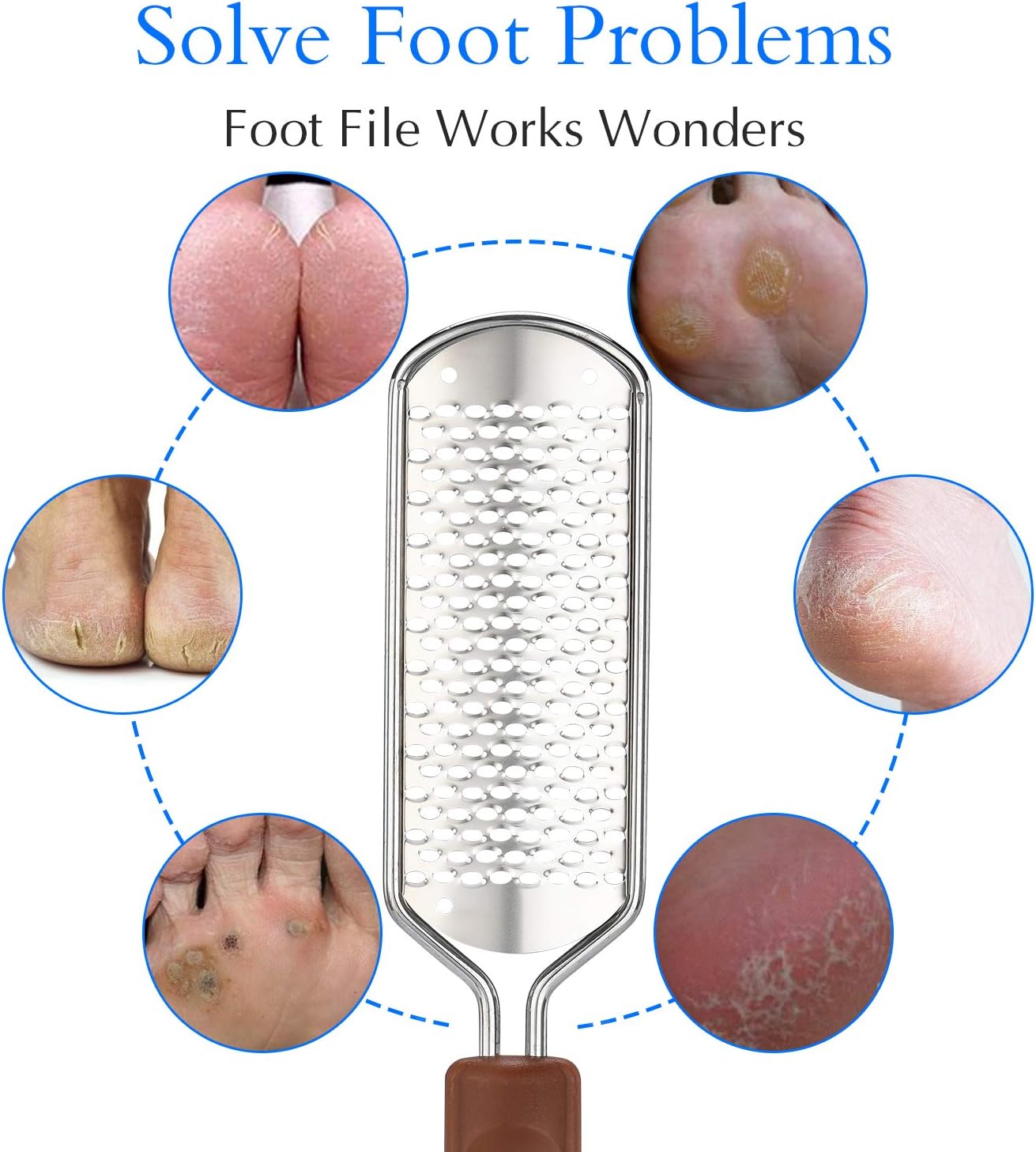 Professional Pedicure Foot File, Colossal Stainless Steel Detachable Foot Scrubber, Hard Skin Removers Pedicure Rasp for Wet and Dry Feet: Health & Personal Care