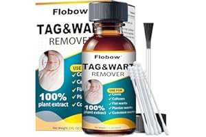 REAUA Skin Tag Removal Kit, Skin Tag Remover - 17% Salicylic Acid Wart Remover Liquid - Acting Wart Removal Freeze Off, Fast-Acting for PlantarWart, Flat Warts, Common Wart, Corn,H Warts, Callus 1Fl oz