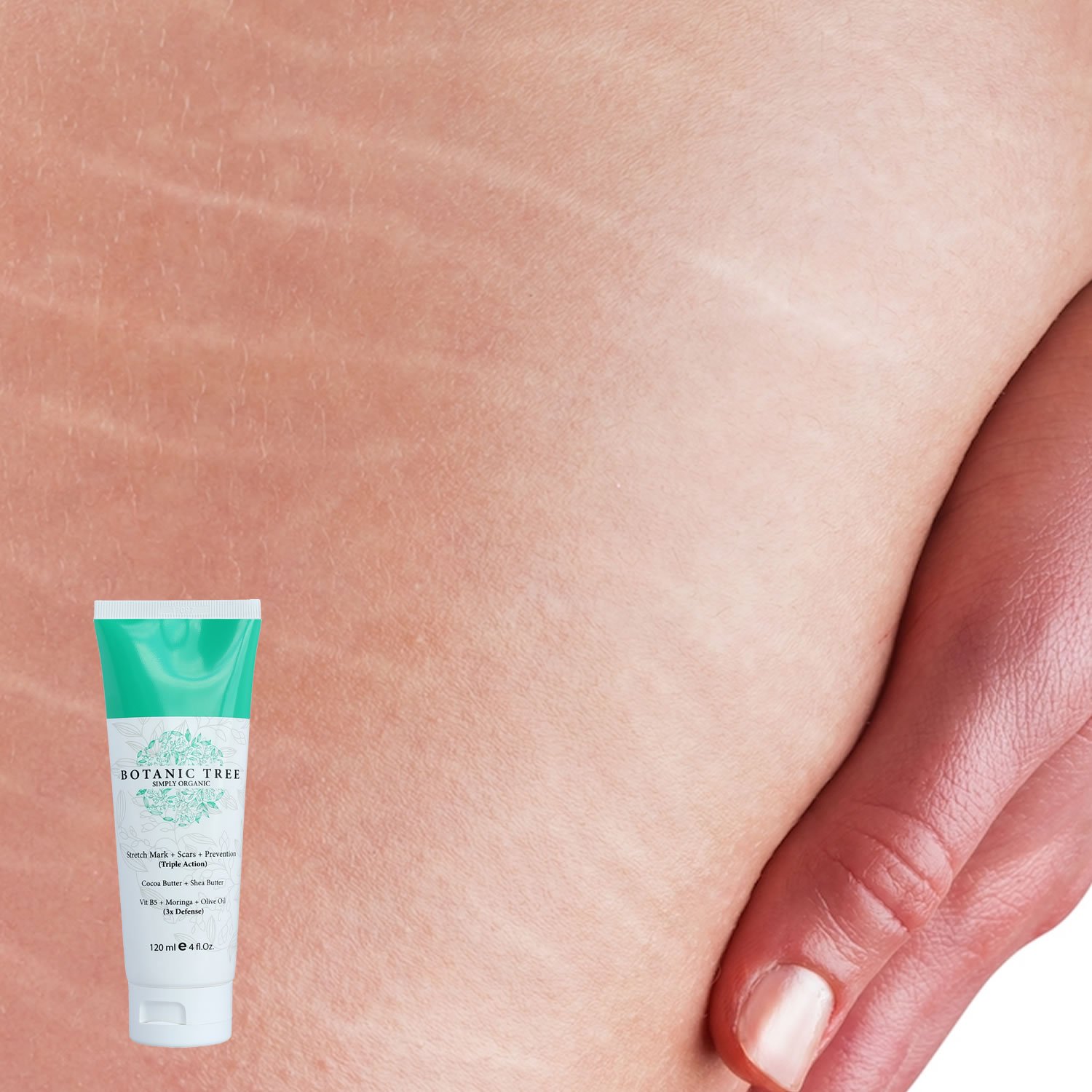 Anti Stretch Mark Scars and Prevention Cream-Decrease Stretc