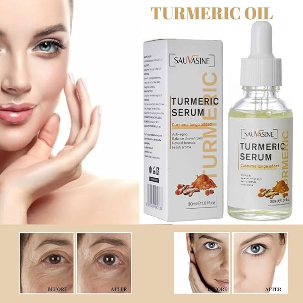 2022 NEW TURMERIC DARK SPOT CORRECTOR SERUM, TURMERIC REPAIR FACE SERUM, BRIGHT SKIN DARK SPOT SKIN CARE MOISTURIZING REPAIR SERUM. 30ML