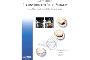 Carpentier's Reconstructive Valve Surgery: From Valve Analysis to Valve Reconstruction