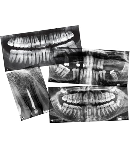APIXIA #2 Size Dental X-Ray Phosphor Plates (PSP) - 4-Pack For Digital Imaging