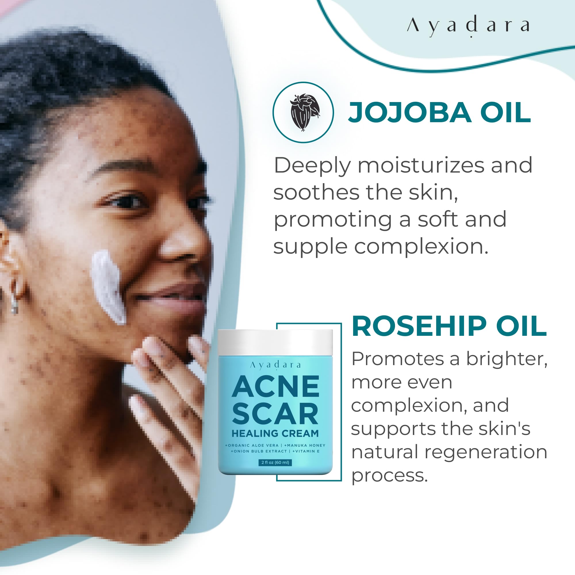 Ayadara Acne Scar Healing Cream, 2 fl oz, Acne Scar Treatment for Face