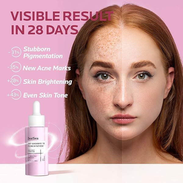 ZEALSEA DARK SPOT CORRECTOR SERUM,EFFECTIVE HYPERPIGMENTATION MELASMA TREATMENT, DARK SPOT REMOVER FOR FACE, GENTLE SKIN CARE FOR ACNE SPOT, BLEMISH SPOT, SUN SPOT, BRIGHTENING FACE SERUM FOR WOMEN
