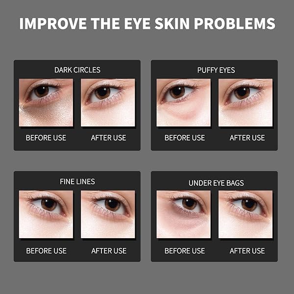 ROUSE BLACK PEARL COLLAGEN EYE MASK ANTI-WRINKLE UNDER EYE PATCHES FOR PUFFY EYES DARK CIRCLES COLLAGEN EYE GEL PAD MOISTURIZING BRIGHTENING UNDER EYE MASK-60PCS