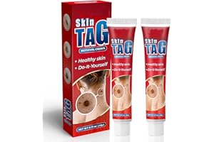 UOSFSRR Fast Action Cream Wart Gel Maximum Strength,Wart Remover,1Pack Wart Ointment with Salicylic Acid, Wart Remover Ontment,Wart Freeze Off,Wart Cream for Common Wart,Plantar Wart,Flat Wart-U5 (2 PACK)