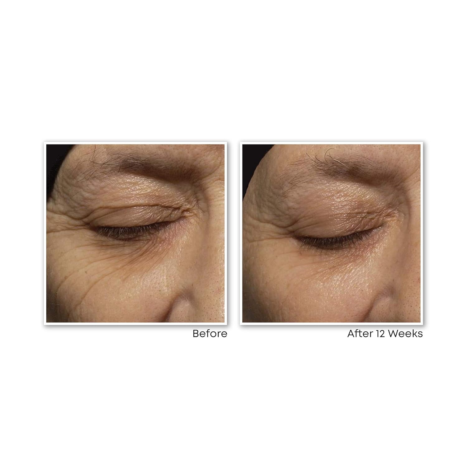 RoC Retinol Correxion Deep Wrinkle Anti-Aging Retinol Night Cream, 1 Ounce: Beauty