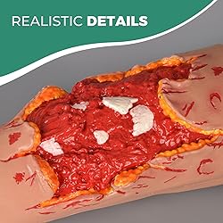 MedEduQuest Wound Packing Trainer, Open Fracture