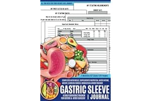 Gastric Sleeve Journal: Daily Bariatric Weight Loss Surgery Planner for Post Surgery & Pre Surgery to Track Meals, Nutrition, Exercise, Weight, Medication & Mood | Gastric Sleeve Gifts for Women