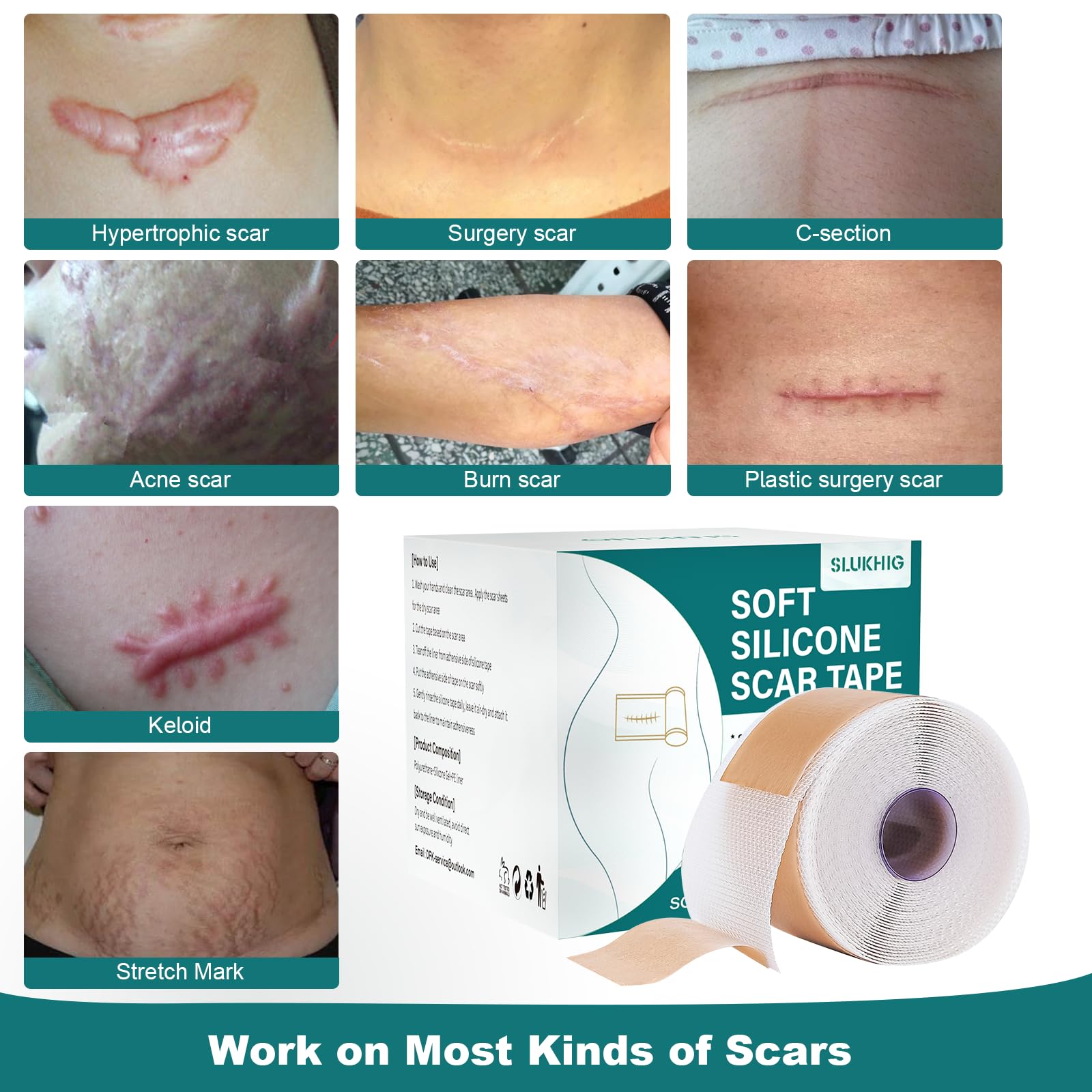 SLUKHIG Silicone Scar Sheets (1.6