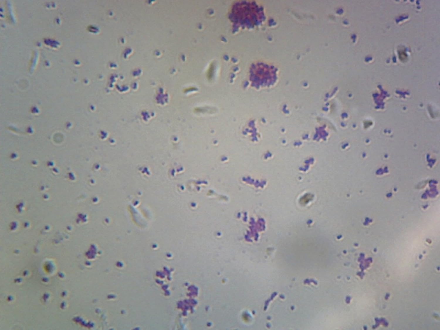 Gram Negative Bacteria Under Microscope