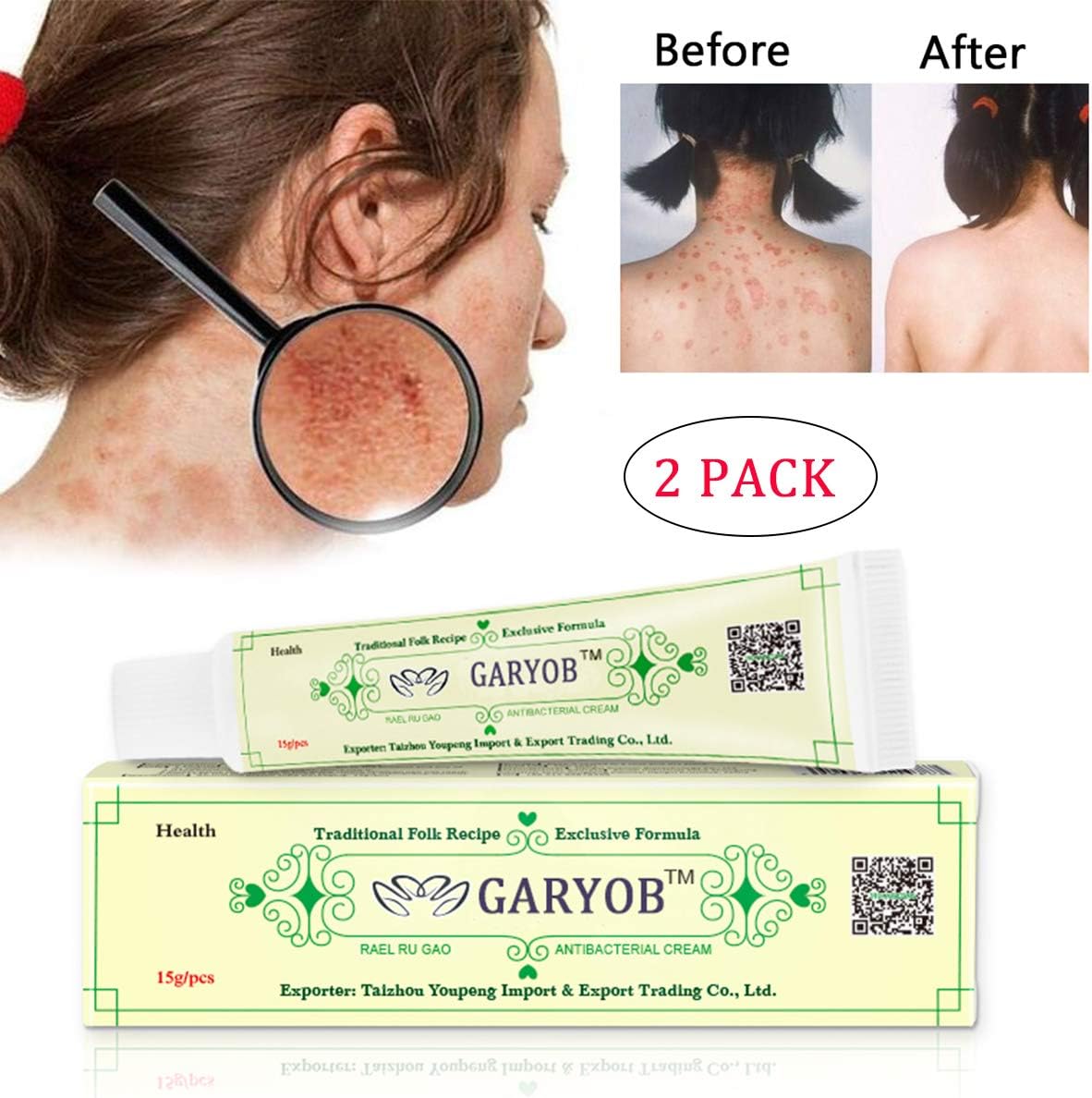 GARYOB 2PACK Antibacterial Cream Natural Gentle Repair Psoriasis Eczema Dry Itching Herbal cream