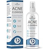 NOVEHA Facial Cleanser For Acne - Hypochlorous Acid Spray - Irritation, Redness & Breakouts Relief - Ideal for Active Teenage & Adult Athletes Post-Workout - Safe for Multiple Daily Uses - 8 oz