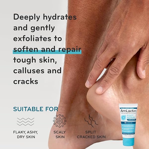 AMLACTIN AWARD-WINNING ESSENTIALS SKIN CARE SET – DAILY NOURISH 12% LOTION, ULTRA SMOOTHING CREAM, FOOT REPAIR CREAM & MOISTURIZING SOCKS – LACTIC ACID MOISTURIZER GIFT SET FOR WHOLE-BODY SKIN RENEWAL