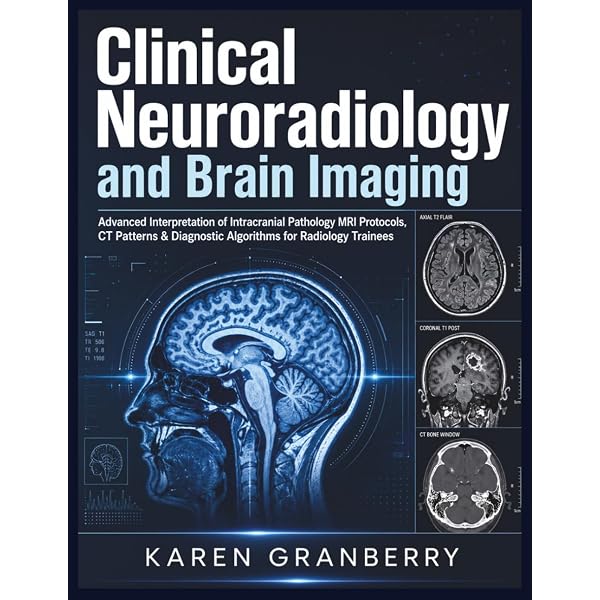 Amazon.com: Medical Imaging Signals And Systems: 9780130653536