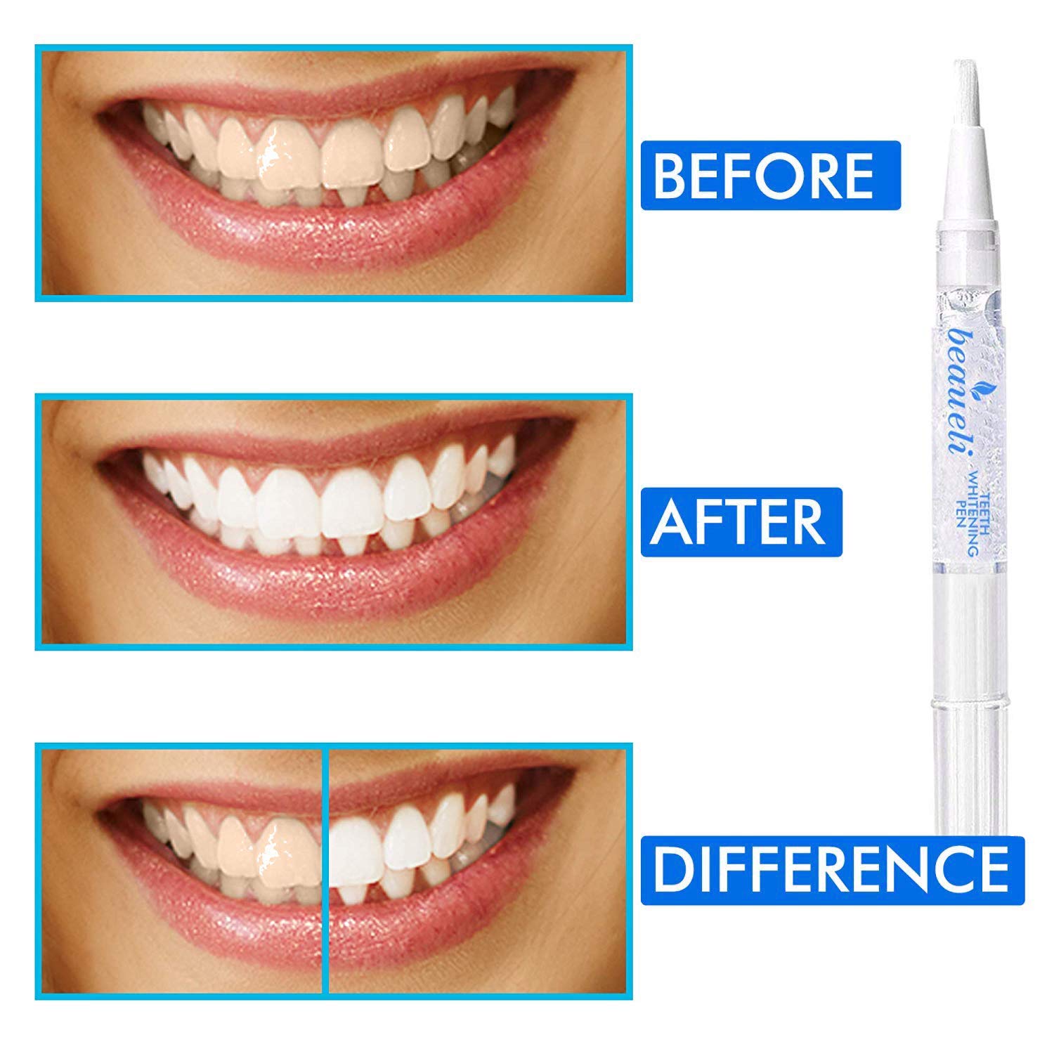Beaueli Teeth Whitening Pen, 3 Pack, 35% Carbamide Peroxide, Natural Mint Flavor, Glycerin Drops, Safe, Easy to Use, Effective, Painless, Travel Friendly, No Sensitivity, Beautiful White Smile : Toothpastes : Beauty
