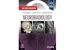 Neuroradiology: The Requisites E-Book: The Core Requisites