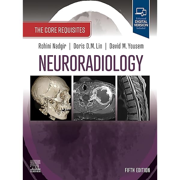 Osborn's Brain:他合わせて5冊 Amazon.com: Osborn's Brain: Osborn's Brain E-Book eBook