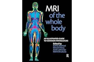 MRI of the Whole Body: An Illustrated Guide for Common Pathologies