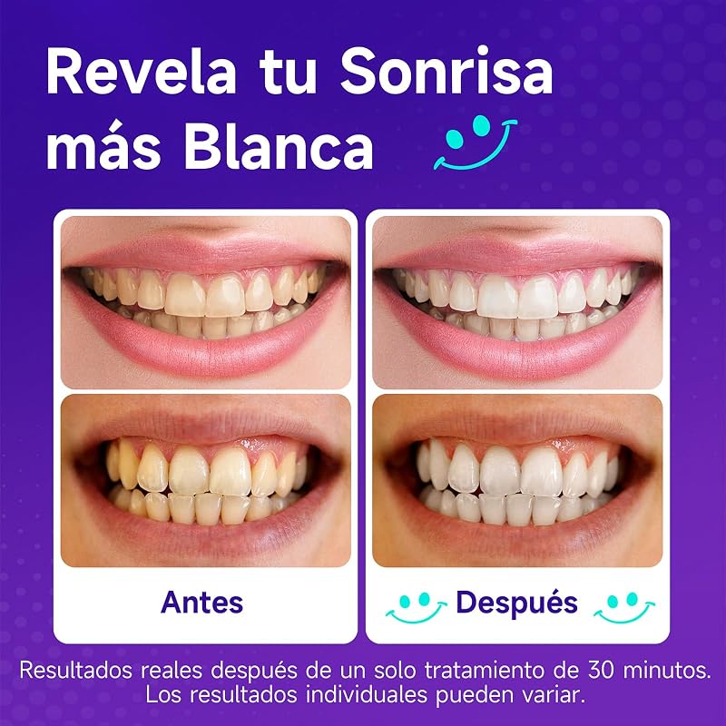 Tiras Blanqueadoras Dientes Moradas: Blanqueador Dental Morado, 7 Tratamiento Efecto Rápido Eliminar Café, Vino, Tabaco Manchas, Seguro Esmalte, Blanqueamiento para Bodas, Citas Trabajar — foto 4 de 8