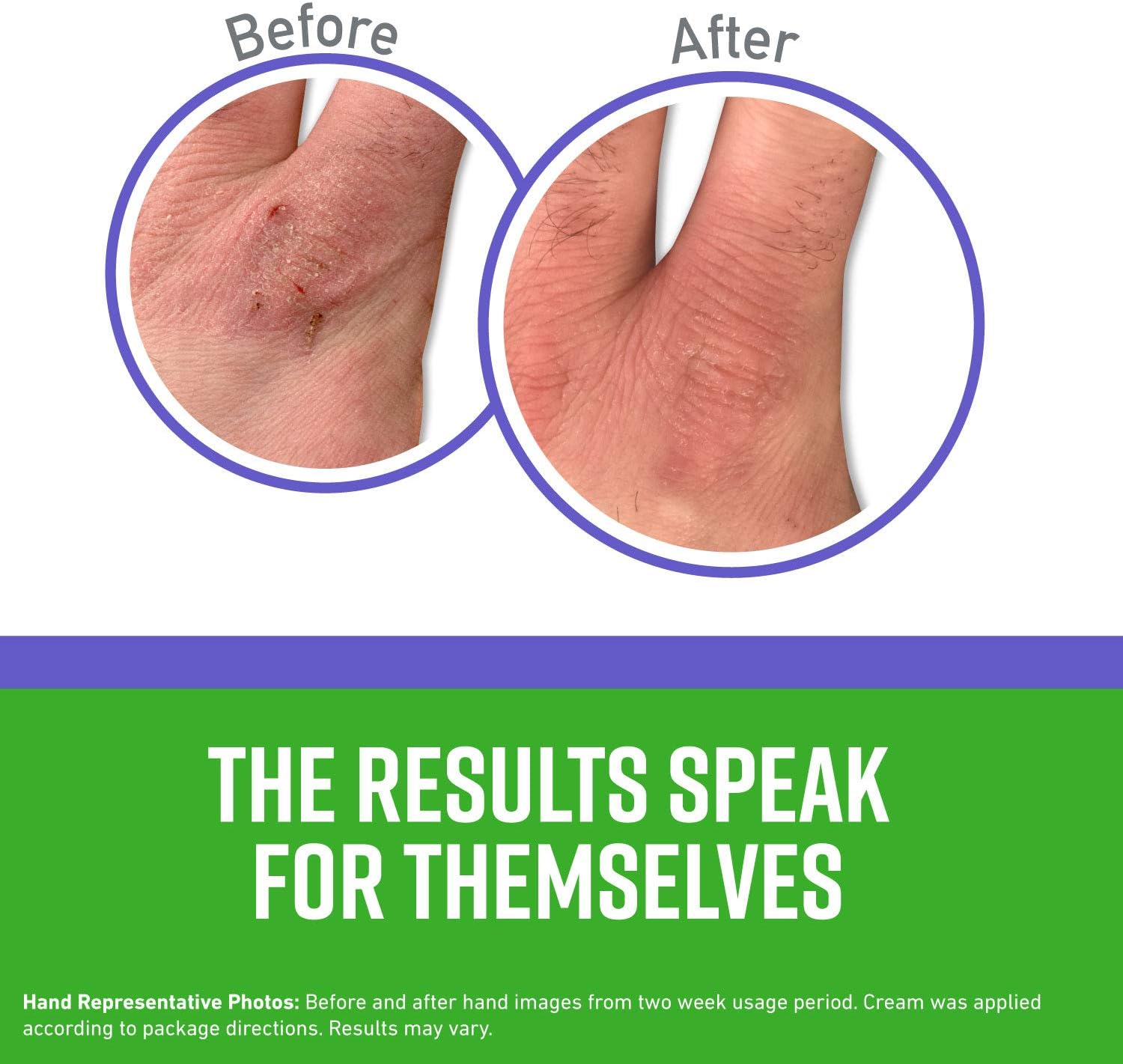 O'Keeffe's Night Treatment Hand Cream, 3 Ounce Tube, White - - 