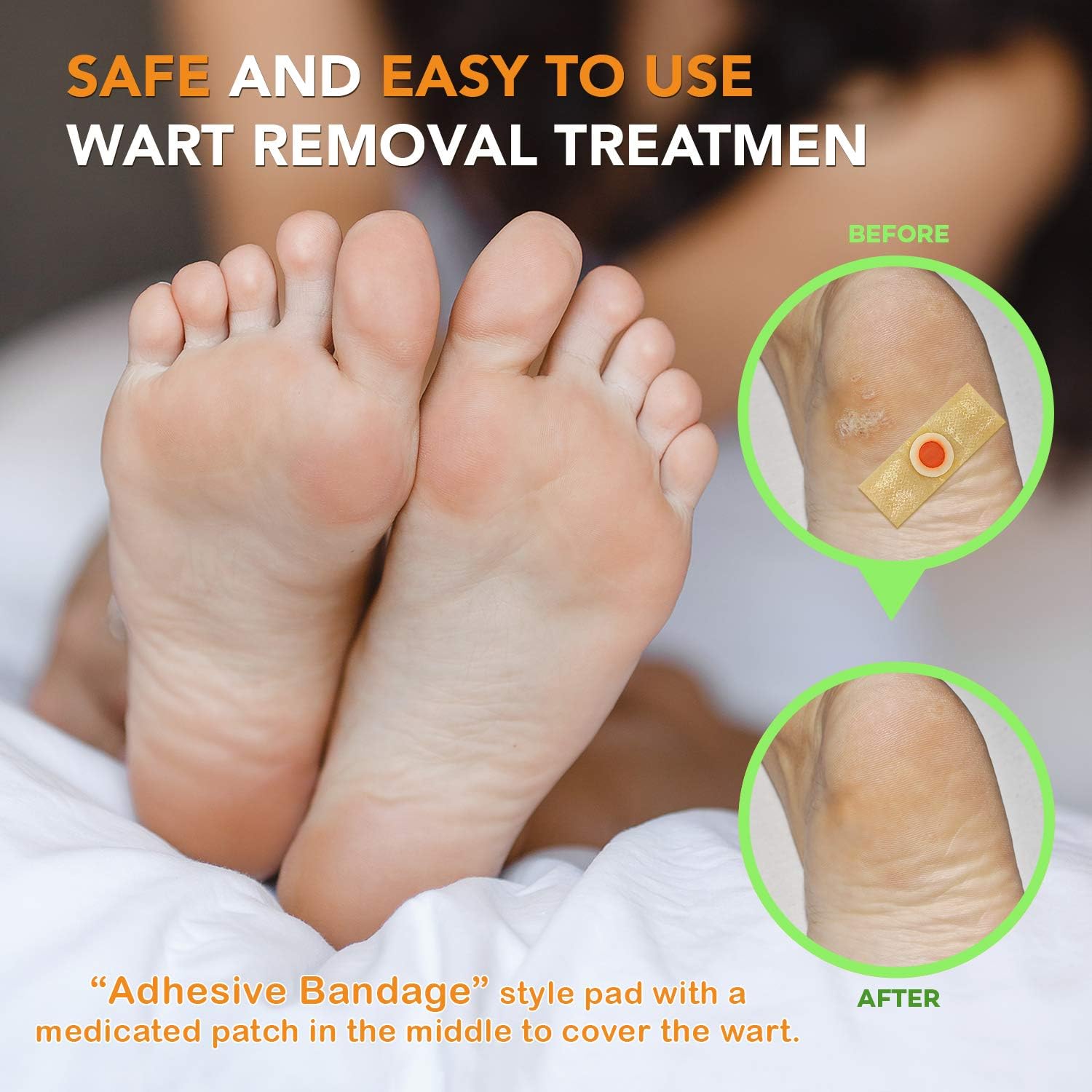 Samsali Wart Remover Pads, Highly Potent Wart Removal Treatment, All New Premium High Efficacy Wart Remover Pads, 42 Wart Remover Pads: Health & Personal Care