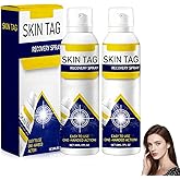 2Pcs ChillErase Bump Renewal Spray,Professional Salicylic Acid Body Serum 2%,ChillErase Spray,Reduces Skin Imperfections,Natural Skin Serum Suitable for All Skin Types