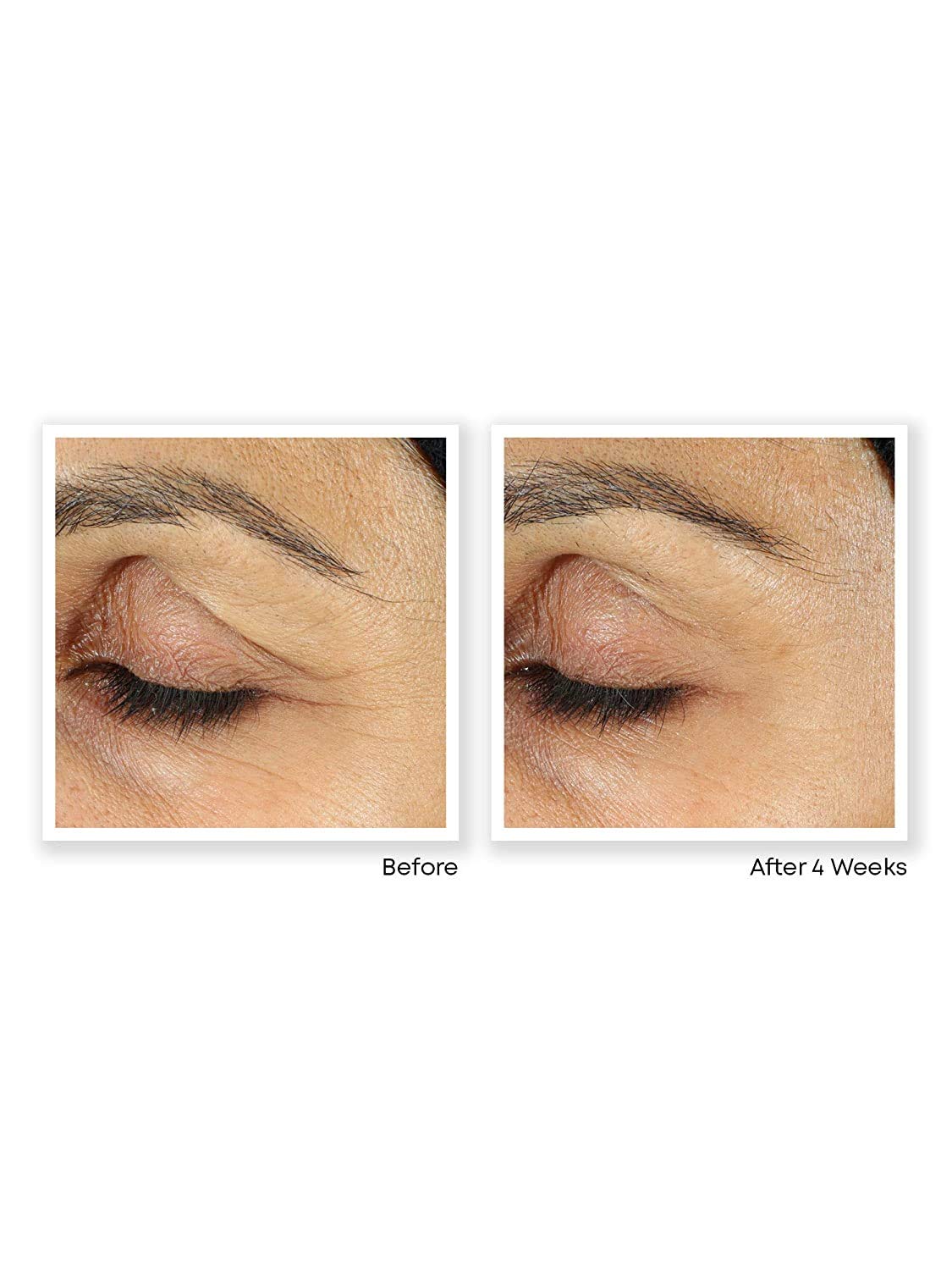 RoC Retinol Correxion Anti-Aging Eye Cream Treatment, 0.5 Ounce: Beauty