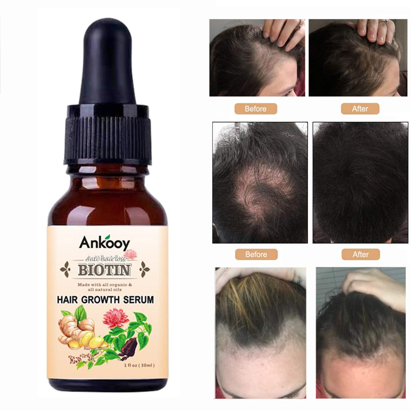 3 PACK Hair Growth Serum, Hair Regrowth Treatment, Stops Hair Loss, Hair Thinning Treatment, Anti Hair Loss, Promotes Thicker, Stronger Hair, And Promotes Hair Regrowth For Women and Men : Beauty