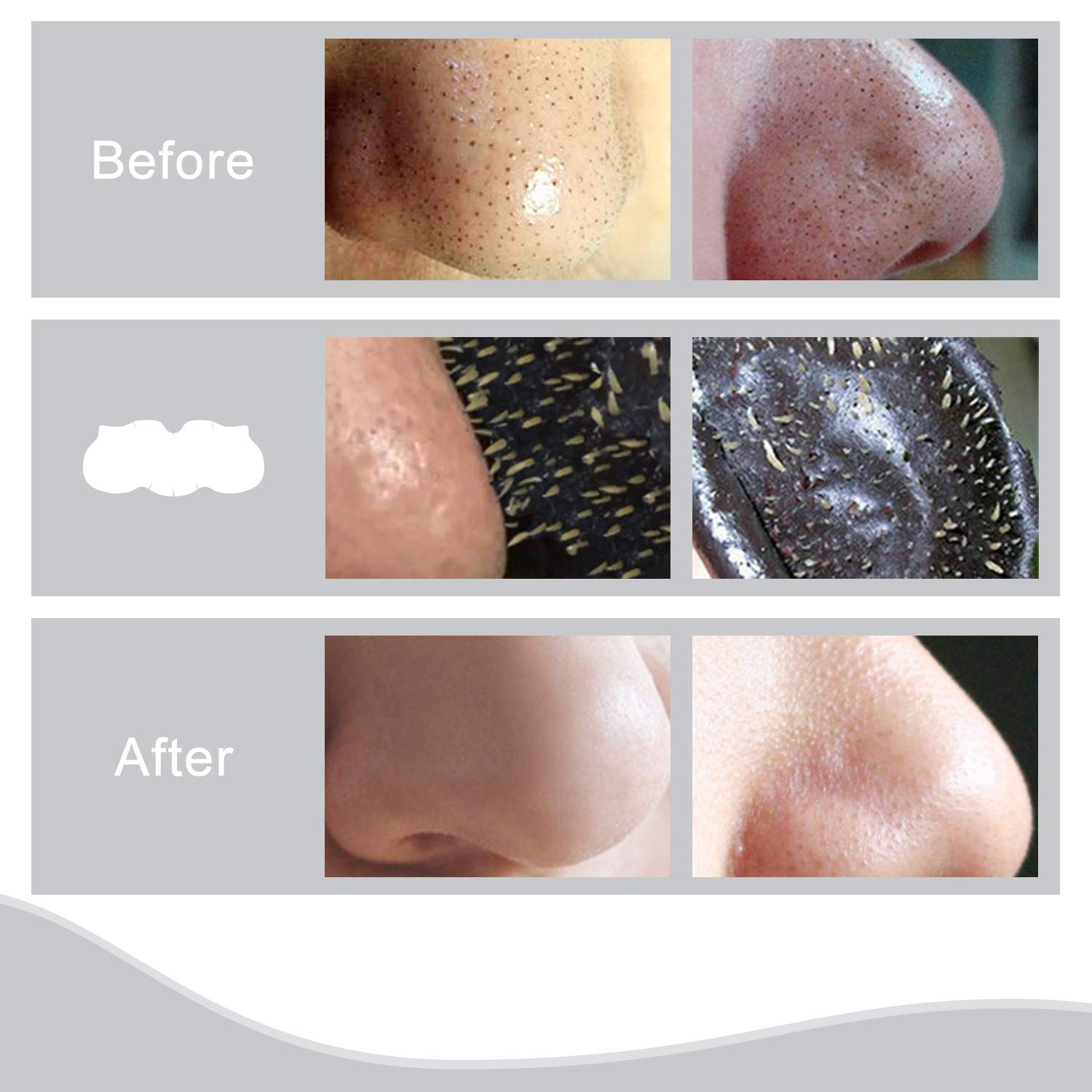 Pore Strips, Charcoal Nose Strips Deep Cleansing Blackhead Remover 24 Strips