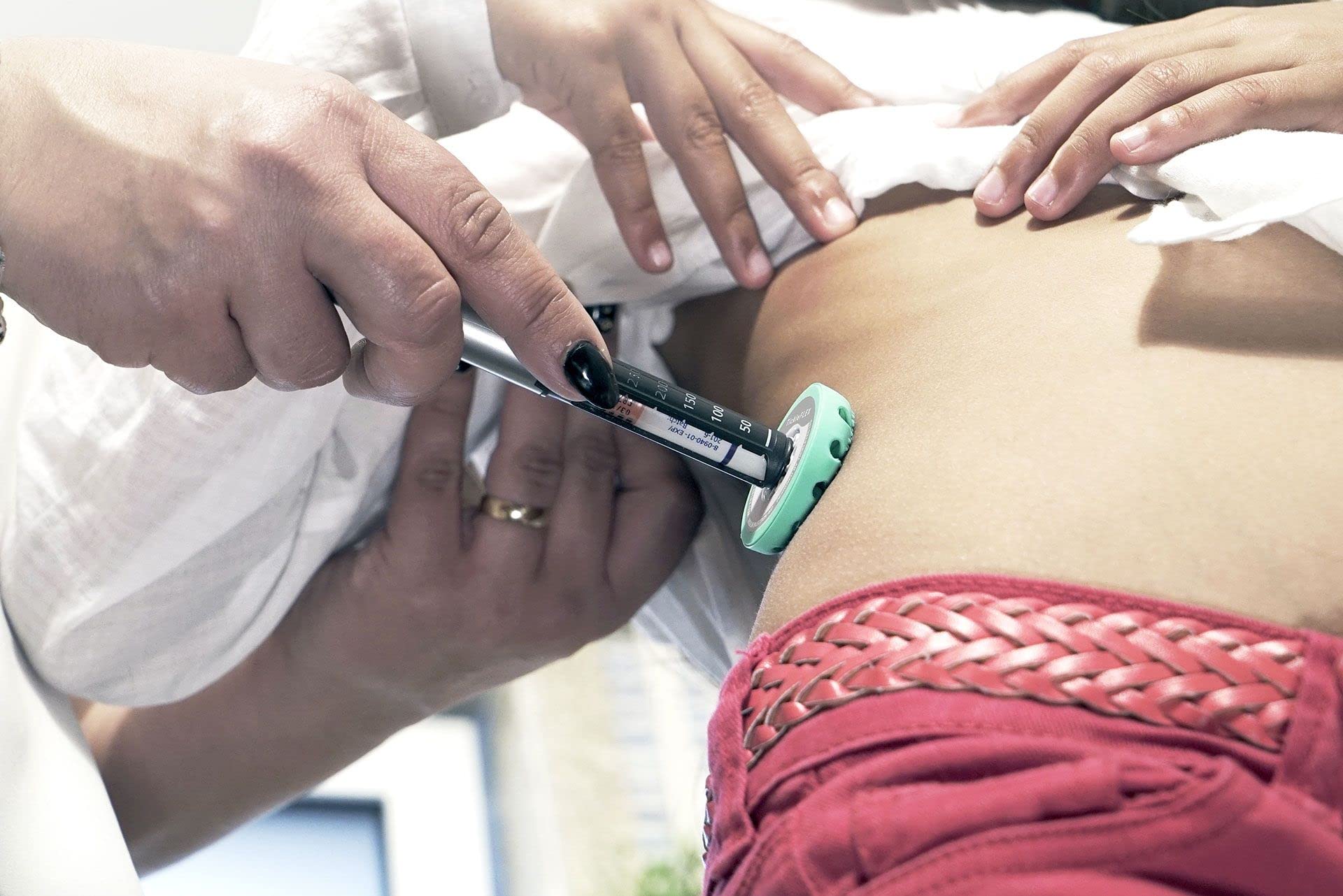 Insulin Pen Needle Injection Aid - Patent Pending Award Winning Universal Fit Add-on for Standard Pen Needles for Reducing Pain, Bruising and Anxiety - Made in UK (TickleFlex)